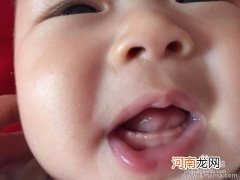 如何判断宝宝长牙了？
