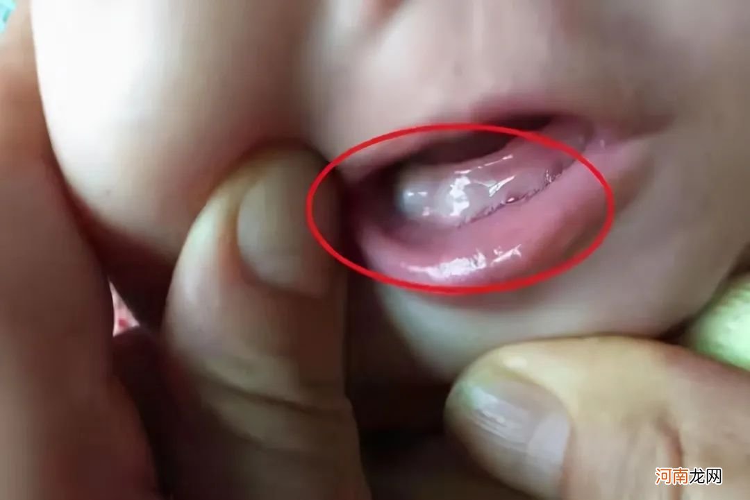 你家宝宝什么时候长牙？宝宝长牙，有什么明显的症状？3个表现父母要牢记?