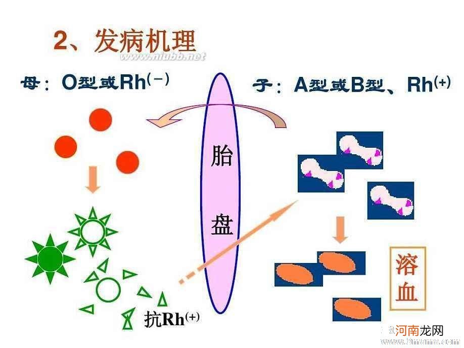 o型血二胎溶血概率