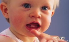 宝宝开始长牙了要怎么护理？