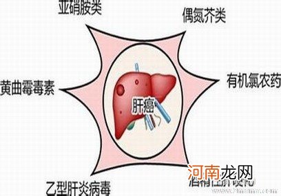 发生的主要病因