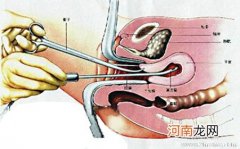 人流为什么要等一年后再怀孕