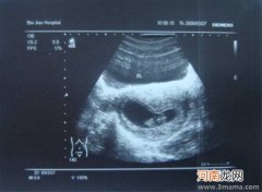 孕中期B超检查的项目