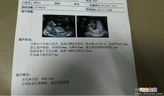 孕早期哪些情况需要做b超检查