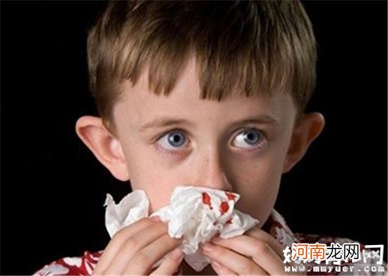 冬季干燥宝宝易流鼻血 家长须知宝宝流鼻血的相关事宜