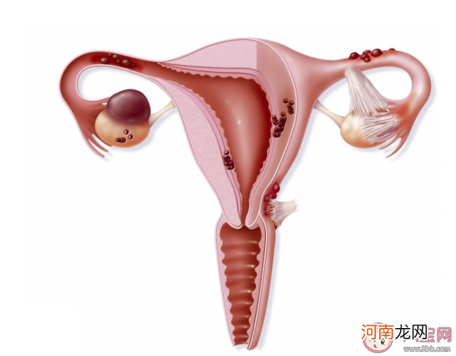 多囊卵巢综合征|患有多囊卵巢综合征就代表不孕吗 没有生育需求多囊不用治疗吗