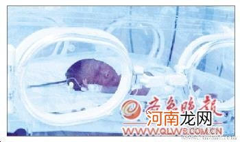 高血压孕妇产下四胞胎 目前母婴均平安