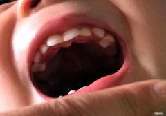 宝宝的出牙规律及护理秘诀