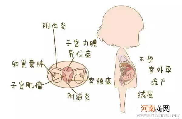 哪些妇科病，更宜看中医