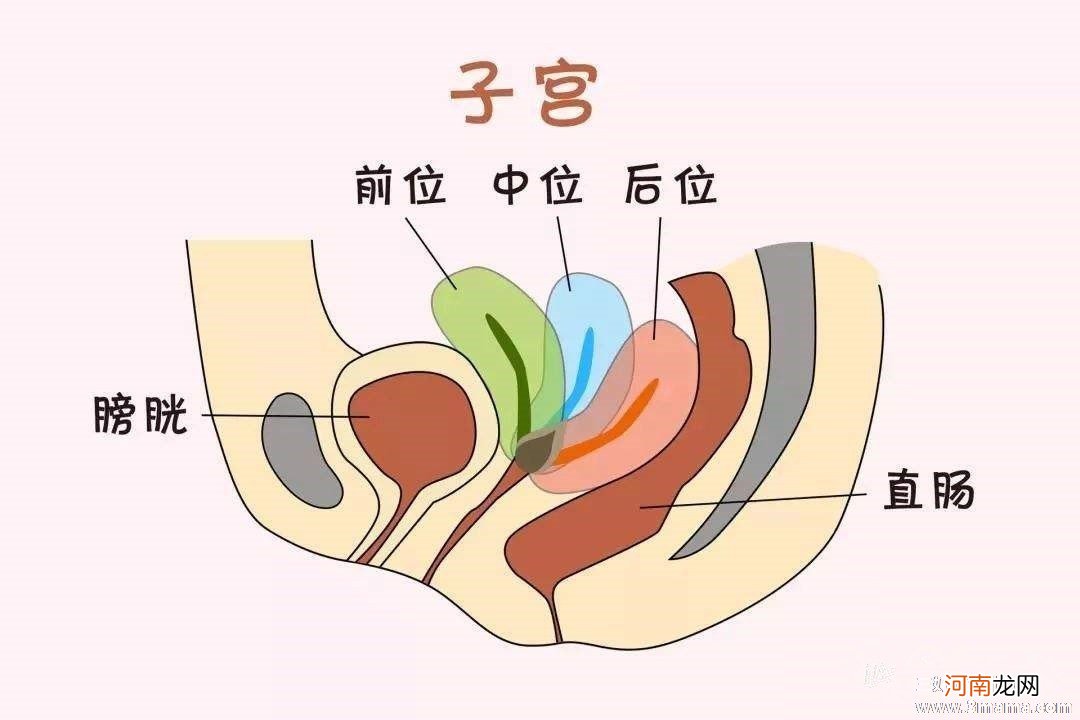 女性子宫前位容易怀孕吗？