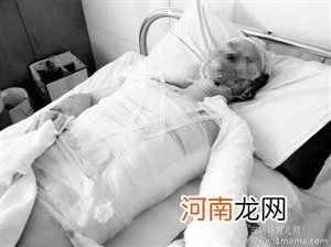 孕妇向已婚男友女儿泼硫酸致孩子全身30%被烧伤