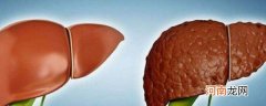 肝脏保养三个小方法 如何养护肝脏 养护肝脏方法