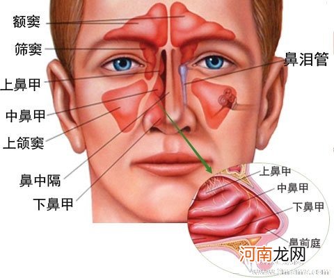 患了过敏性鼻炎有哪些表现？