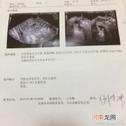 流产后多长时间可以再怀孕