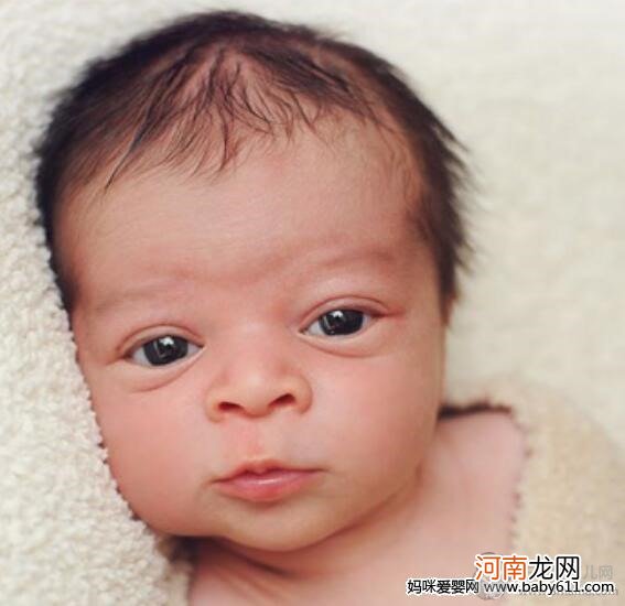 教你如何发现新生儿疾病 做个细心的妈妈