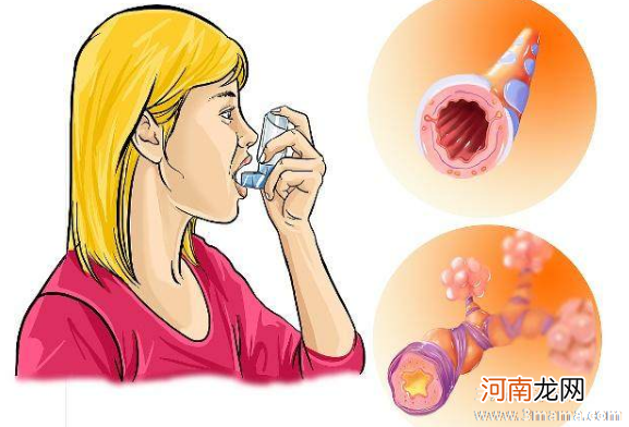 儿童过敏性哮喘的治疗方法