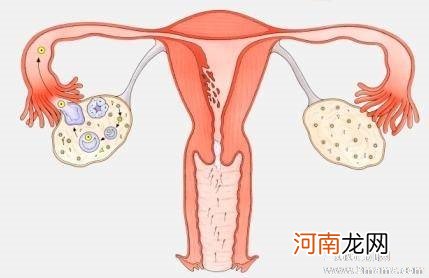 多囊卵巢综合症的症状