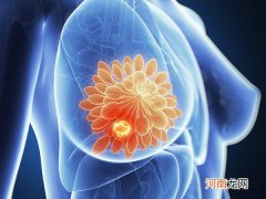 乳房能挤出水是什么原因导致的