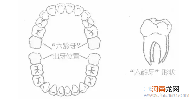 六龄齿＂劳苦功高＂,龋坏率高