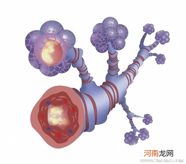 导致支气管炎的主要因素有哪些？