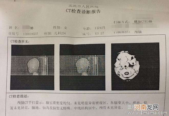 手足口病都有哪些发病病因呢