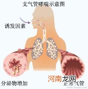 小儿支气管哮喘的危害有哪些呢