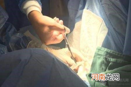 二胎剖腹产后做结扎手术 结扎对女性身体影响有多大