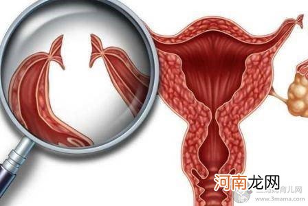 二胎剖腹产后做结扎手术 结扎对女性身体影响有多大