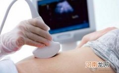 孕期产检 发现脐带绕颈怎么办