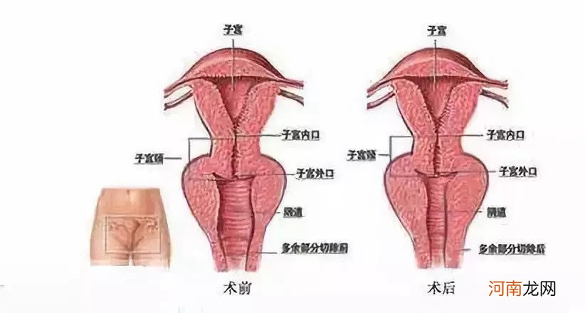 下面出气一定是松弛吗