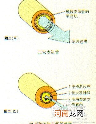 小儿支气管哮喘用什么方法治疗最好