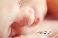 刚出生的婴儿鼻子上有小白点？宝妈不要轻举妄动！
