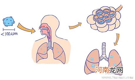 支气管炎的发病的六大原因