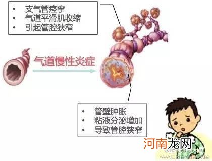 小儿哮喘的治疗用药原则有什么呢？