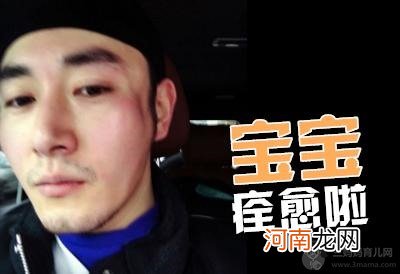 果郡王李东学现状毁容生活困难真假？李东学老婆周沫个人资料图片