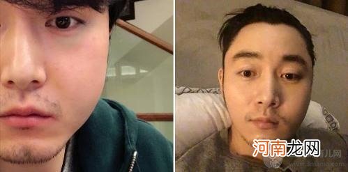 果郡王李东学现状毁容生活困难真假？李东学老婆周沫个人资料图片