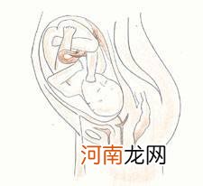 孕15周胎儿4维彩超图