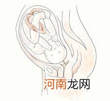 孕15周胎儿4维彩超图