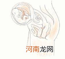 孕15周胎儿4维彩超图