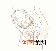 孕15周胎儿4维彩超图