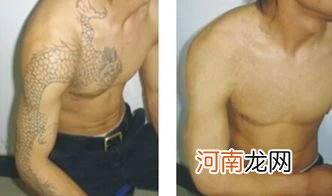 去纹身一般多少钱