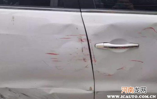 凹痕无损修复后悔死了吗?汽车无痕修复汽车凹陷靠谱吗