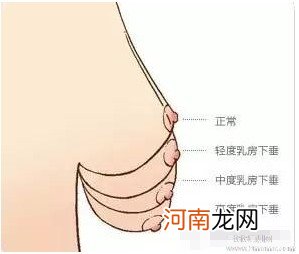 母乳喂养真会引起乳房下垂这个问题吗