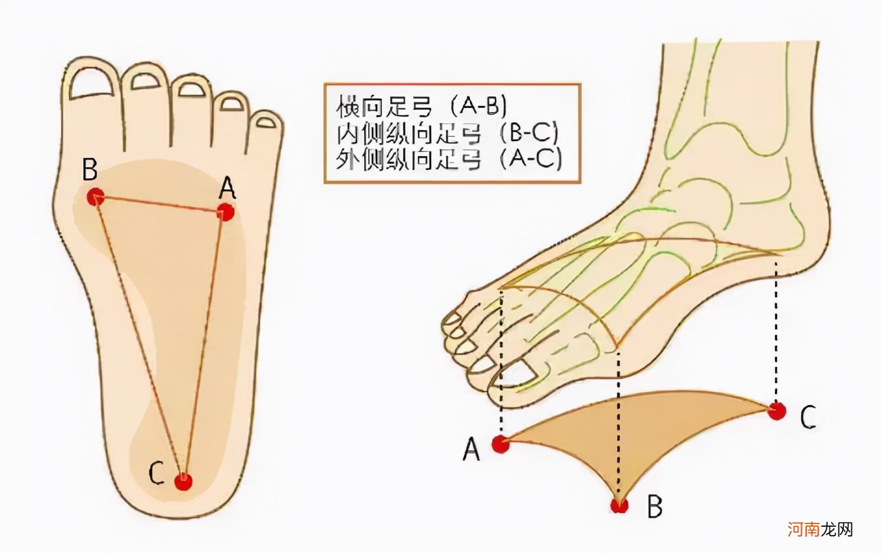 走路疼是怎么回事 脚底板有硬块走路疼是怎么回事？