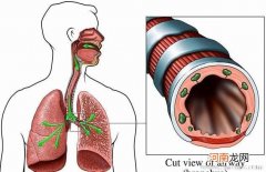 支气管炎的主要表现是什么