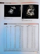 孕14周胎儿生长指标