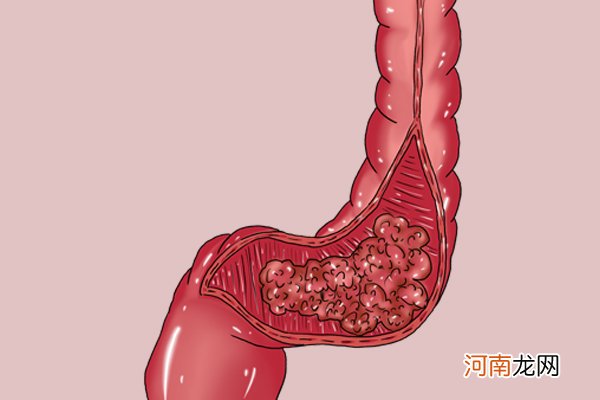 吃红薯是胖还是减肥 吃红薯减肥还是胖