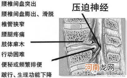 引起手足口病出现的因素有哪些