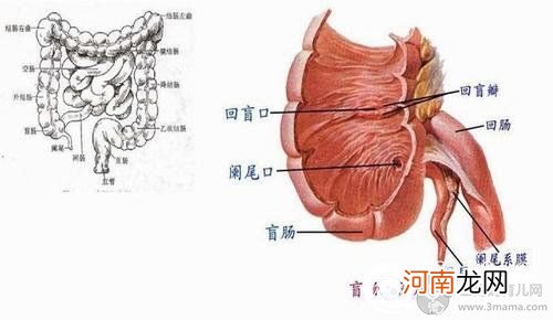 阑尾炎是怎么引起的 得了阑尾炎需要注意什么？