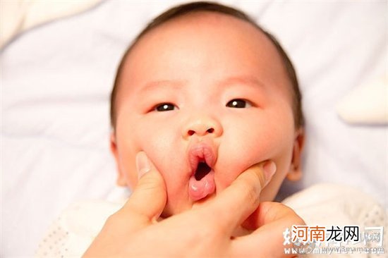 初生婴儿嘴唇脱皮正常吗 如何护理宝宝嘴唇脱皮